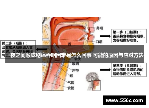 一夜之间喉咙剧痛吞咽困难是怎么回事 可能的原因与应对方法