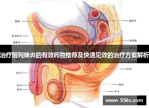 治疗前列腺炎的有效药物推荐及快速见效的治疗方案解析